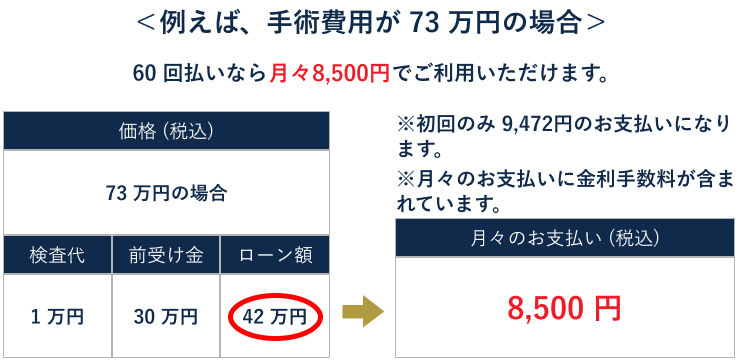 ICL手術73万円の場合の60回払いの分割価格表